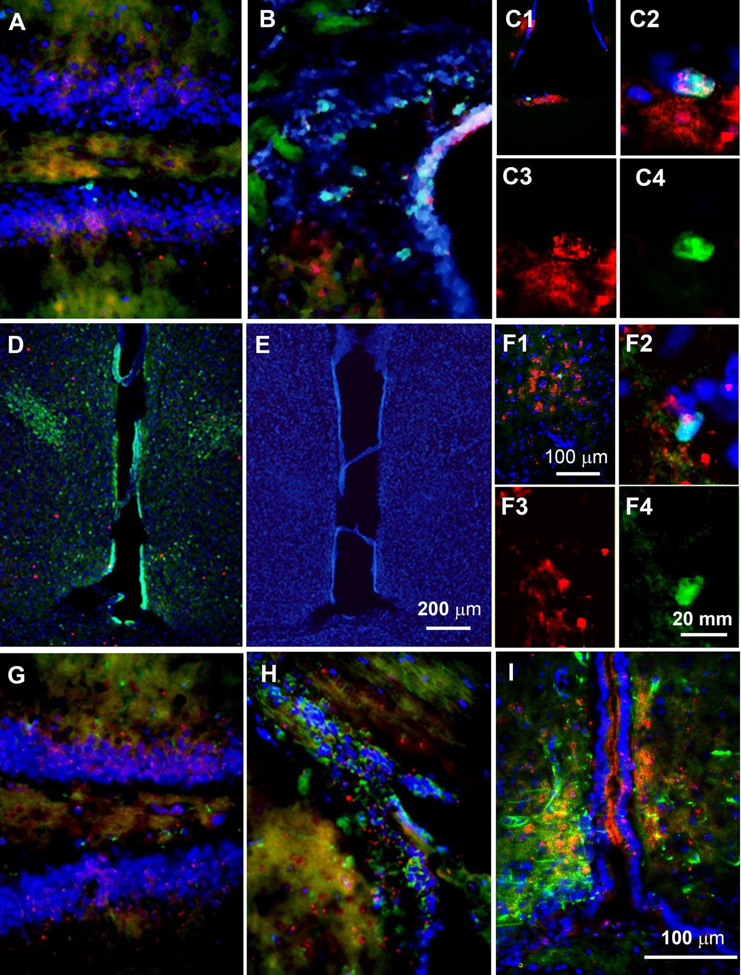 ERβ-ir cells that express the stem cell markers Ki67 or nestin. Representative images are displayed for immunoreactivities for nestin or Ki67 (both with green fluorescence) and ERβ (red fluorescence) in the subgranular zone (SGZ: A&G) and the subventricular zone (SVZ: B&H). Both regions are well-accepted stem cell reservoirs in the brain. The granular neurons in the dentate gyrus (A&G), used here as a positive control, typically express ERβ (red). A subset of the Ki67-positive cells in the 3rd ventricle stem cell niche (3VSCN) express ERβ (C1), while the co-localization of Ki67-ir (C4) and ERβ (C3) is amplified in C2. Similarly, a subset of Ki67-ir cells express ERβ in the SDN-POA territory (F1) and the co-localization of Ki67-ir (F4) and ERβ (F3) is magnified in F2. Many ependymal cells in the 3VSCN express ERβ in association with nestin (I). Images A, B, G, H & I were acquired under the same magnification conditions and, thus, share the size bar in Image I. In similar fashion, C1 and F1 share the bar in F1; C2-4 and F2-4 share the bar in F4, and Image D and E share the bar in E. Noticeably in D, the green fluorescence indicates CB28 localization while the red fluorescence indicates Ki67. The images E and F1-4 were acquired from the same animal and adjacent to the tissue section presented in Image D (addressing Ki67-positive cells within territory of the SDN-POA); images F1-F4 were acquired from the tissue section presented in Panel E and represent magnified images. Using a similar strategy as presented in Fig.1A & C, Image E demonstrates that the Ki67-positive cells expressing ERβ are included within the SDN-POA territory identified by its characteristic density (arrow-indicated) in association with the surrounding anatomical landmarks including the 3rd ventricle (3V) and the optic chiasm (OC). All images in Fig. 2 were acquired from weanling rats.