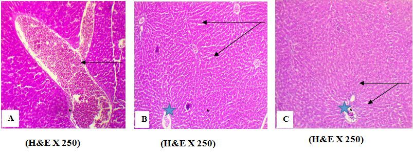 Effect of AFB1 on liver tissues. A photomicrograph of liver section from (A) Liver of  rat treated  with AFB1 alone (group 2) showing a sinusoid capillary dilation with hemorrhagic contents (arrow), (B) rat treated with AFB1 + EELac  at 300 mg/kg (group 5)  showed  the normal  hepatocytes (arrow) ¶  and  portal area (star) without histological abnormalities¶, (C) rat Treated with AFB1+ BHA at 50 mg/kg (group 6)  showed the normal  hepatocytes  (arrow) ¶  and  portal area (star) without histological abnormalities.