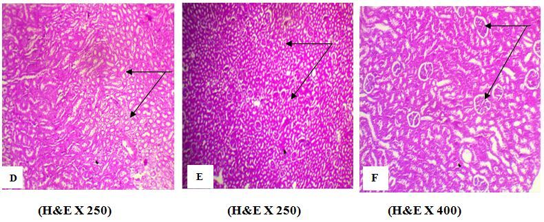 Effect of AFB1 on kidney tissues. A photomicrograph of kidney  section from (D) kidney  of  rat treated  with AFB1 alone (group 2) showed an atrophy of renal tubules (arrow), (B) Rat Treated with AFB1 + EELac at 300 mg/kg (group 5)  showed a normal histology  of  renal  tubules (arrow), (C) Rats Treated with AFB1 + BHA  at 50 mg/kg (group 6)  showed a normal histology  of  renal tubules and  renal glomeruli (arrow). ¶