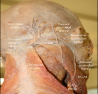 Anatomy of the occipital region, modified from an image from Bodies, The Exhibition, with permission. Note the connection of the greater and lesser occipital nerves. (Image courtesy of Andrea Trescot