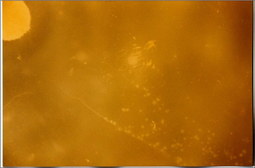 Sensitivity of the isolates to digitonin (x 10).