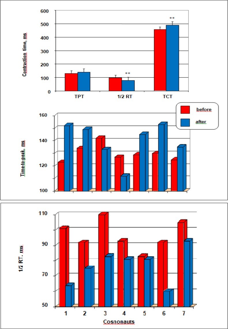 The effects of long-term space flights on velocity properties. Time-to-peak twitch (TPT), and time to half-relaxation (1/2 RT), and total contraction time (TCT) before and after prolonged space flights (top panel), and the histograms represent the individual TPT (middle panel), and made an interval  1/2RT (bottom panel) values of each cosmonaut from baseline data collections and 3 days after return test. All values are means ± SE. Significantly different between groups for corresponding contractions: **p < 0.05