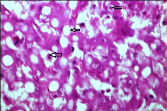 liver (dead cattle less than 1 year old) showed hepatocytes suffering hydropic degeneration. And necrosis  (H&E, X 60).