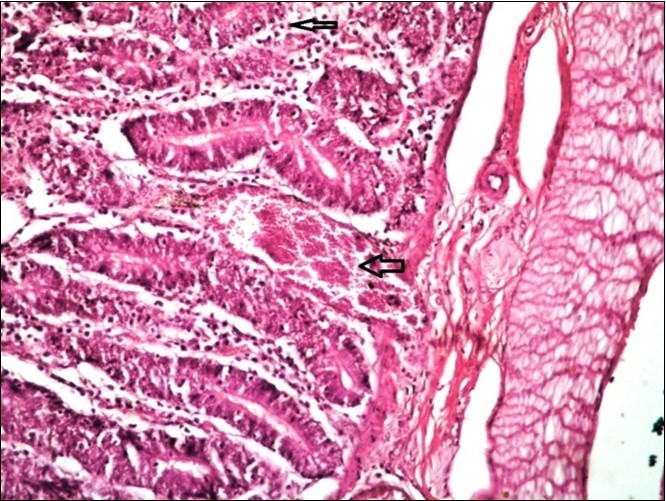 Small intestine (dead cattle less than 1 year old) showed hydropic degeneration, congested blood vessels, inflammatory cells  (H&E, X 30).
