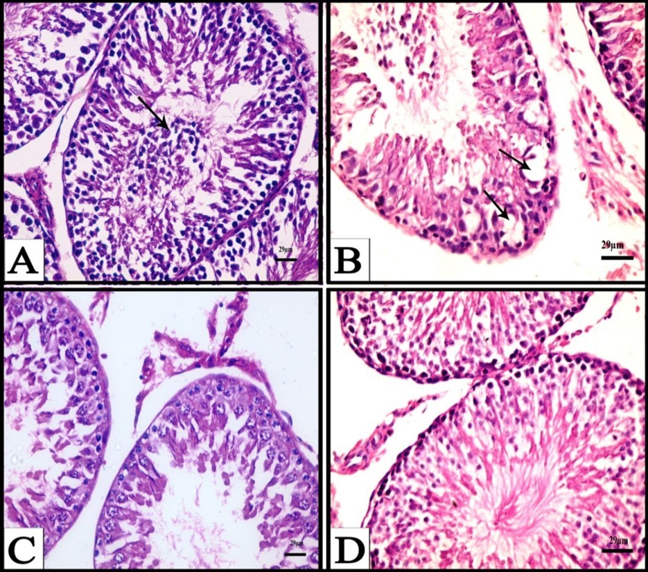 A) A Photomicrograph obtained from testis of a rat treated with CPA for six weeks showing exfoliated cells (arrows), (H&E).  B) A Photomicrograph obtained from testis of a rat treated with CPA for six weeks showing appearance of vacuoles (arrows) and degenerated spermatogenic cells, (H&E). C) A Photomicrograph obtained from testis of a rat treated with CPA for six weeks showing degenerative interstitial tissue and reduced and n degenerated  spermatogenic cells, (H&E). D) A Photomicrograph obtained from testis of a rat treated with CPA followed by fennel oil for six weeks showing advanced degree of improvement of seminiferous tubules and increase of spermatogenic layers, (H&E).
