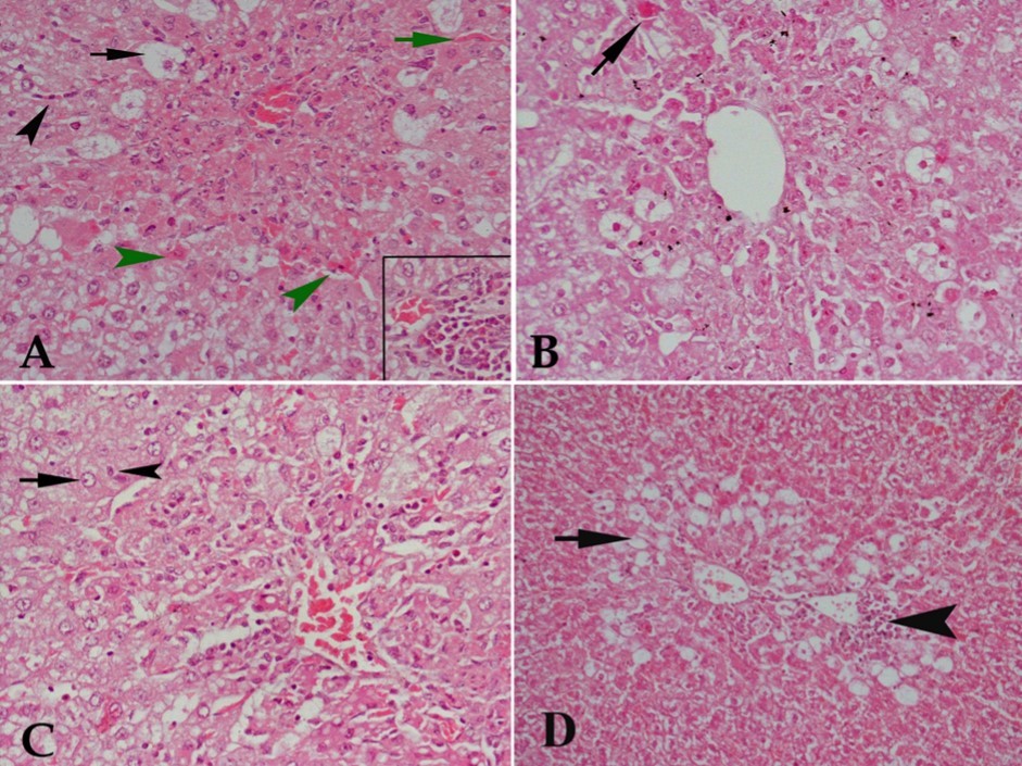 Hx & E stained liver tissue from (A) control rat receiving CCl4 showing severe degenerative changes in liver tissue in the form of marked vacuolar degeneration of many hepatocytes (black arrow), acidified hepatocytes (green arrowhead), congestion of blood sinusoids (green arrow) and  cellular infiltration either diffuse in the center of the lobule or in blood sinusoids (black arrowhead). The lower right part of the figure shows focal aggregation of cellular infiltrates.  (B)  CCl4 and 10 mg/kg buspirone showing no protective effect against the damaging effect of CCl4 as acidified cells (arrow), vacuolar degeneration of most hepatocytes and cellular infiltration are still observed. (C) CCl4 and 20 mg/kg buspirone showing minimal protection against the damaging effect of CCl4 as some cells appear with normal nuclei (arrow) and others are with pyknotic nuclei (arrowhead), although many cells show vacuolar degeneration, cellular infiltration in the center of the lobule is still present and architecture of liver tissue is markedly deformed. (D)  CCl4 and 30 mg/kg buspirone showing mild protection of the drug against the damaging effect of CCl4 . Cellular infiltration is localized at focal areas beside central vein (arrowhead) with restriction of vacuolar degeneration to the area around central vein (arrow).