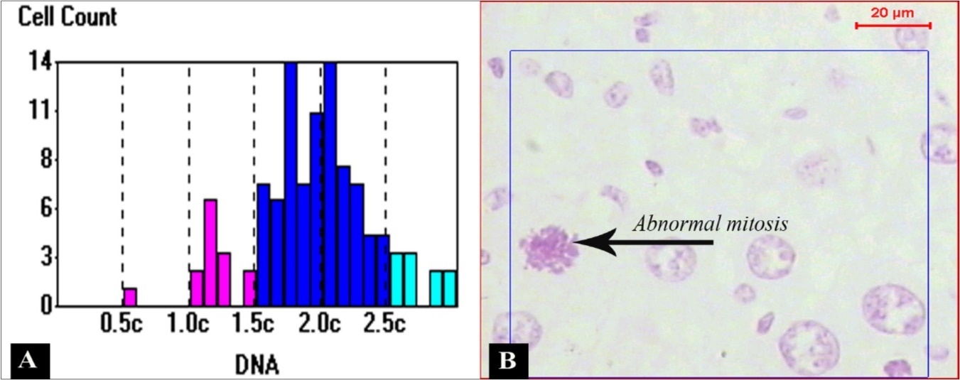 (A) A chart showing the distribution of DNA content in normal hepatic cells. Notice that most of cells contain the normal content of DNA (2C). (B) Shows abnormal mitosis in Feulgen-stained sections of liver tissue.