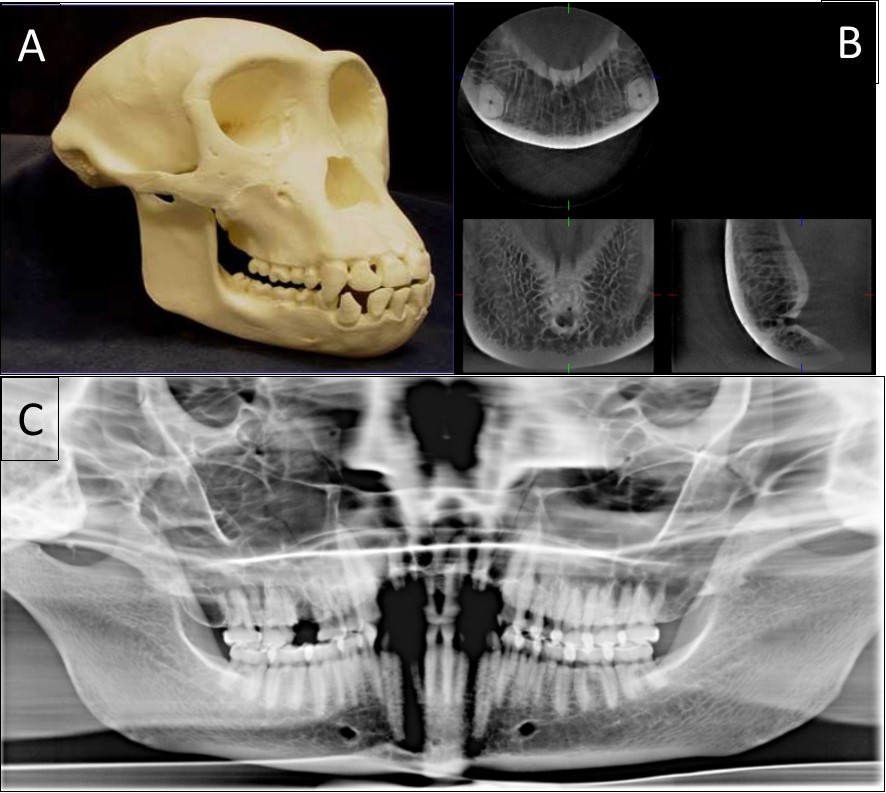 The classical sample images with different anatomical features. A general view of a 20-year-old chimpanzee (A), its three-dimensional CBCT view (B) and two-dimensional panoramic view (C).