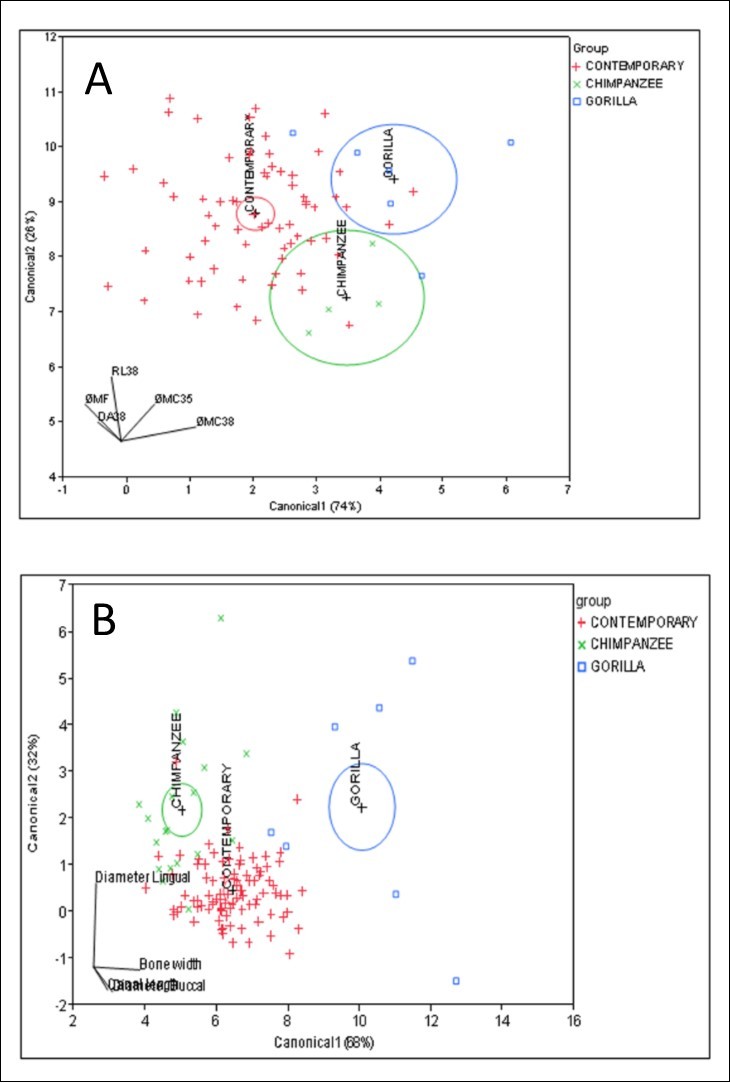 Linear discriminant analyses from the canonical plots show interspecific results of neurovascular canal features between Gorilla (*), Chimpanzee (Í) and contemporary Human mandibles (+), with distinctive, non-overlapping distributions in (A) and (B). RL 38: root length of #38 tooth; DA38: distance canal to root apex of #38 tooth; φMC38: the diameter of mandibular canal at molar #38; φMC35: the diameter of mandibular canal at premolar #35; φMF: the diameter of mandible mental foramen.