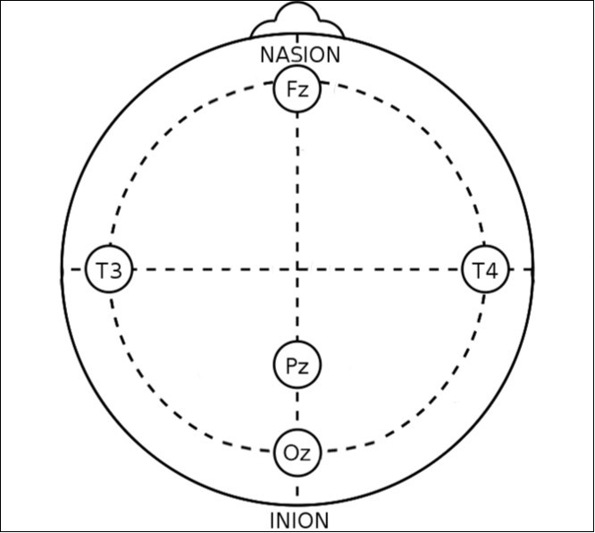 Placement of the EEG electrodes