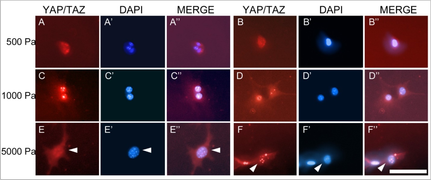 Immunohistochemistry for the YAP/TAZ complex in Müller cells at 20 days in culture. The YAP/TAZ complex is localized to the nucleus in cells grown on 500 Pa (A,B) and 1000 Pa (C, D) gels as shown by the corresponding DAPI staining of nuclear DNA (A’, B’, C’, D’). The YAP/TAZ complex in cells grown on 5000 Pa gels (E, F) is primarily localized in the cytoplasm as demonstrated in the corresponding DAPI stain (E’, F’). Scale bar: 50 microns.