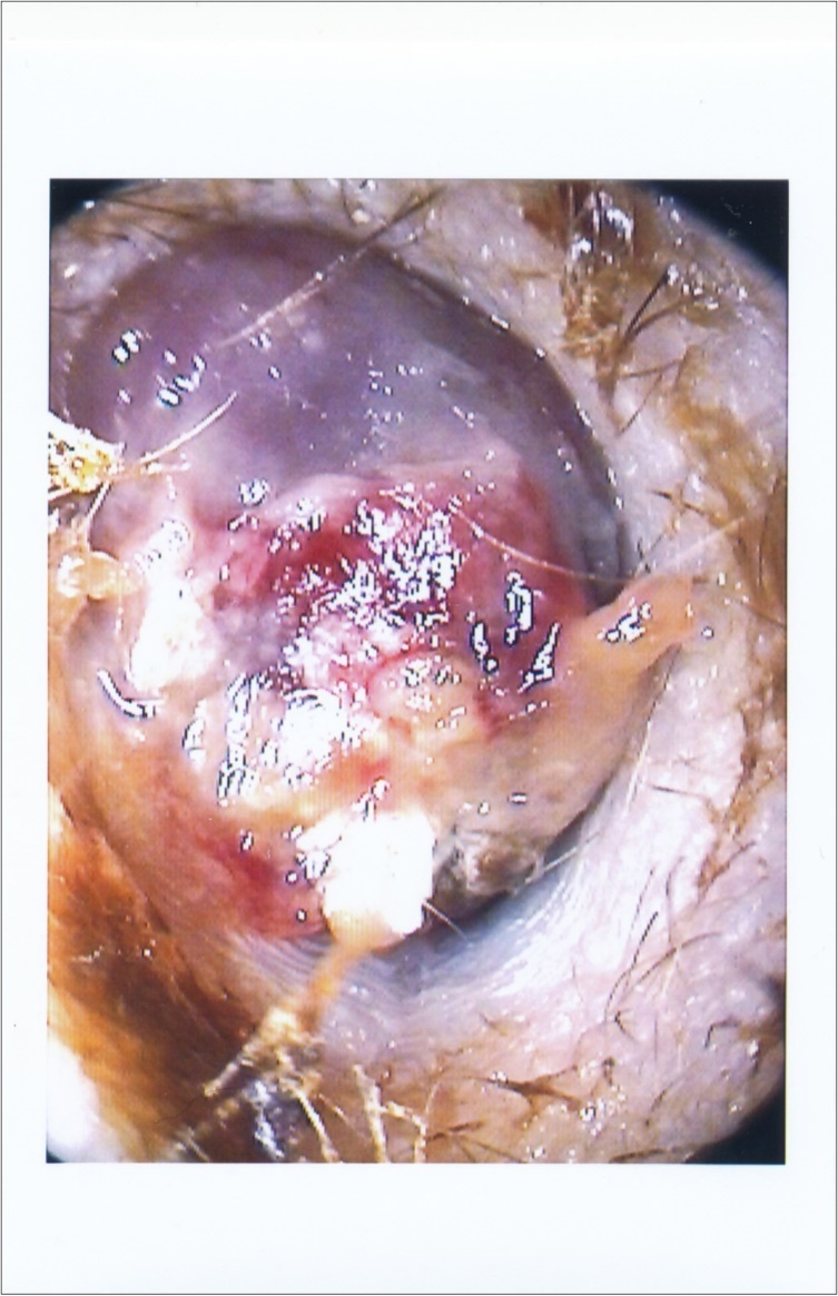 Right ear shows reddish-purple mass