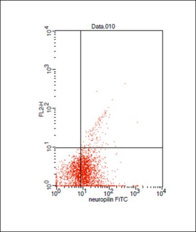Dot plot showing AML case with positive Neuropilin -1 expression (63.9%)