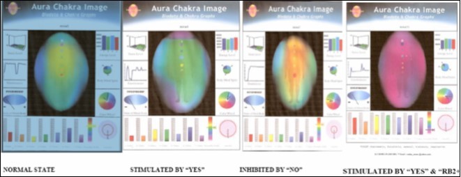 Stimulating or inhibitory modifications of the BPL states accorded to the simple 3 minutes of saying / thinking: YES / NO.