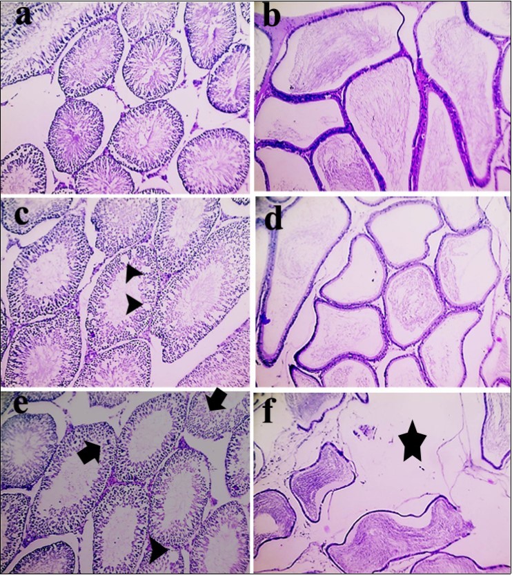 Sections from control group; the testes (a) and epididymis (b) display normal histological structures. In second group (BPA 10 μg/kg); testes (c) with arrowheads pointing to vacuolar degeneration in  germinal epithelium lining some seminiferous tubules. While, epididymis (d) shows partial emptying epidydmal ducts. In third group (BPA 15 μg/kg); Testis (e) with arrowhead pointing to vacuolar degeneration in germinal epithelium lining some seminiferous tubules and arrows pointing to necrosis in germinal epithelium. Meanwhile, epididymis (f) with a star marking severe edema and widely separating epididymal ducts (X: 100).