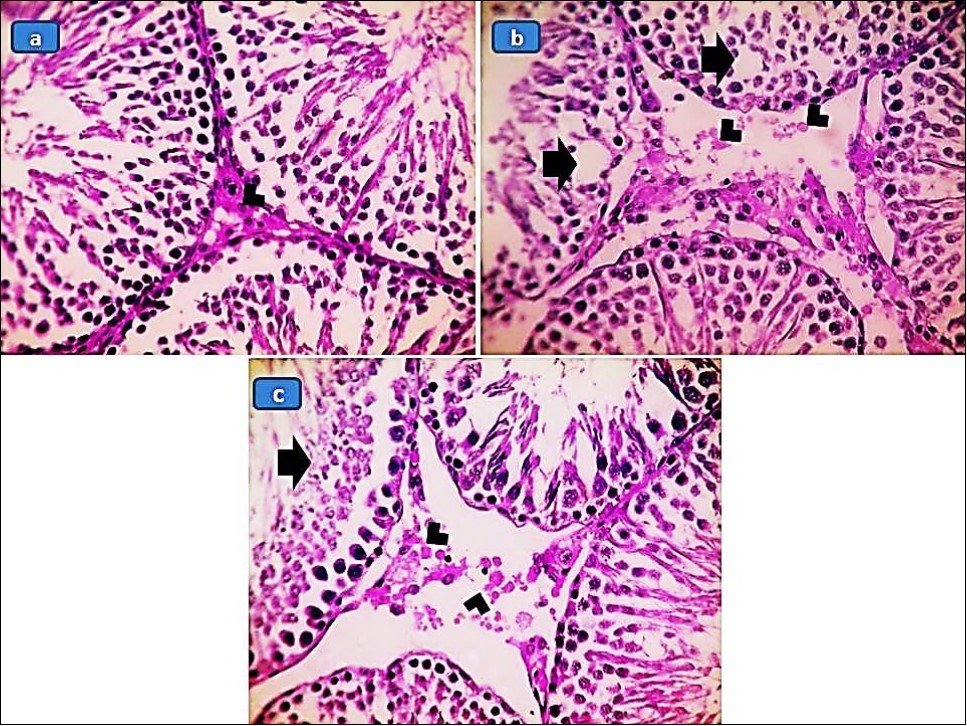 (a) Testis from control group shows normal germinal epithelium and interstitial Leydig cells (arrowhead). (b) Testis from second group (BPA 10 μg/kg) shows vacuolated spermatocytes (arrows) and necrotic interstitial Leydig cells (arrowheads). (c) Testis from third group (15 μg/kg) shows necrotic spermatocytes (arrow) and necrotic interstitial Leydig cells (arrowheads) (H&E, X:200).