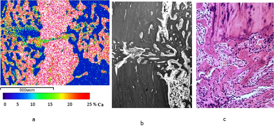 The calcium content (a) and the structure (b, c) of regeneration in the zone of the tibia fracture fusion in the animals of the experimental group 7 days after the operation; a – images in the characteristic X-ray radiation of calcium atoms, b – light microscopy of histological sections, staining by Van Gieson (b) and        hematoxylin-eosin (c), lens 10, eyepiece 10