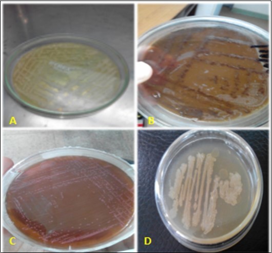 Streak plating of bacterial on their respective    differential medium. A=  Staphylococcus aureus on Staph 110 agar, B= Salmonella spp. on                     Salmonella-Shigella agar, C= E. coli on MacConkey’s agarand D= Bacillus subtilis on Eosin methylene         blue agar