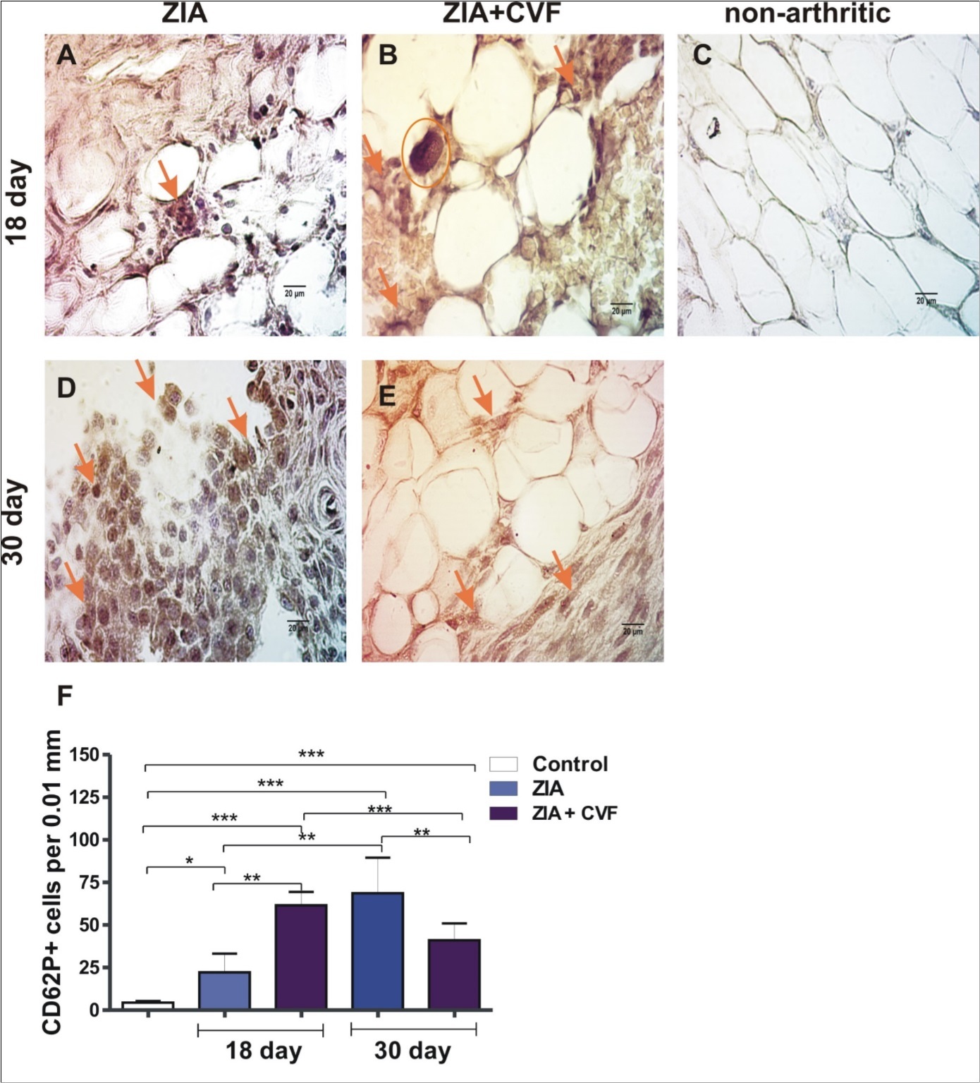 Histochemically stained CD62P+ cells in the synovium. (A) arrow showed stained CD62P+ cells in ZIA at day 18; (B) arrows showed stained CD62P+ cells in ZIA+CVF at day 18 and a circle around mature MK with platelets; (C) non-arthritic group; (D) arrow showed stained CD62P+ cells in ZIA at day 30; (E) arrows showed stained CD62P+ cells in ZIA+CVF at day 30; (F) graphic presentation of results, scale bar - 20µm, *p<0.05, **p<0.01, ***p<0.001, two way ANOVA.