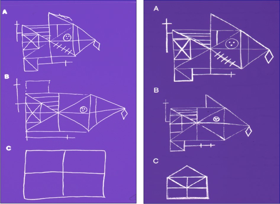 Performance of the anterogradely amnesic patient E in the so-called Rey-Osterrieth Figure, a complex drawing which the patient had to draw repeatedly. The patient first is shown the figure and has to draw it from the original (A). Thereafter she had to draw it a second time by heart after half an hour(B), then a third after an hour (C), and finally a fourth time after 2 hours (E was unable to reproduce it then). Patient E performed the test 3 years (left half of the figure) and 5 years (right half) after amnesia onset. Patient E was able to copy the figure without problems (A), she also was considerably above average when drawing it by heart after half an hour (B); but then, after a              further half hour her performance was massively below expectation, and after 2 hours she – on both occasions – did not even remember having drawn the picture.