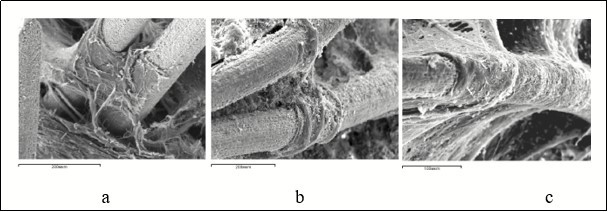 Connective-tissue cover on the implant surface in the defect periosteal zone 7 (a) and 14               (b, c) days after surgery. Scanning electron microscopy, magnification × 160.