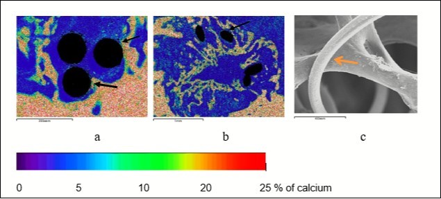 Reparative osteogenesis in the metaphyseal defect 7 (a) and 14 (b, c) days after surgery, arrows indicate the areas of osteointegration; a, b – maps of x-ray electron probe microanalysis, image in                             characteristic X-ray emission of calcium atoms, c – scanning electron microscopy (organic components removed with 6% sodium hypochlorite solution), magnification: а - × 100, b - × 25, c - × 70.