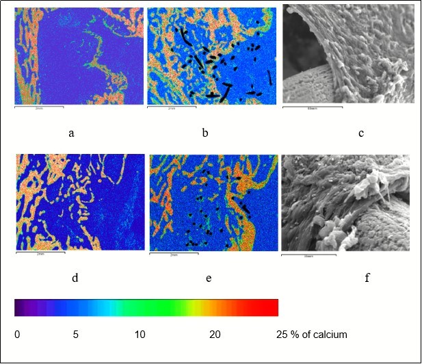 Reparative bone formation in the defect of femoral metaphysis in the control (a, d) and                     experimental (b, c, e, f) group of animals; a, b, c - 30 days after operation; d, t, f - 60 days after                            operation; a, b, d, e – maps of x-ray electron probe microanalysis, image in characteristic X-ray               emission of calcium atoms, magnification × 20; c, f – scanning electron microscopy, magnification:               c - × 670, f – 800.