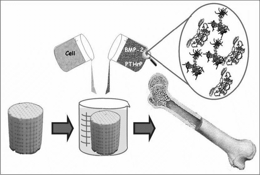 A schematic view of a third generation biomaterial, in which porous CaPO4                  bioceramics acts as a scaffold or a template for cells, growth factors, etc. Reprinted from Ref. 65 with permission.