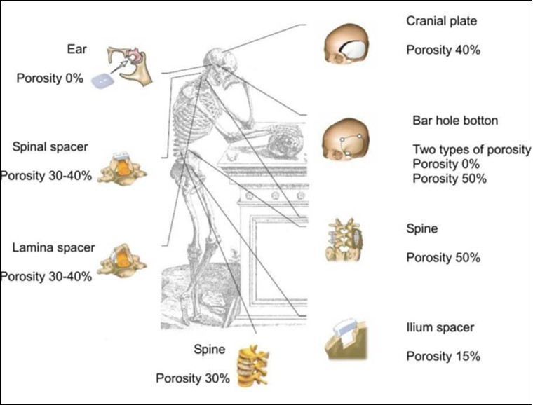 A schematic drawing presenting the potential usage of bioceramic               scaffolds with various degrees of porosity. Reprinted from Ref. 66 with permission.