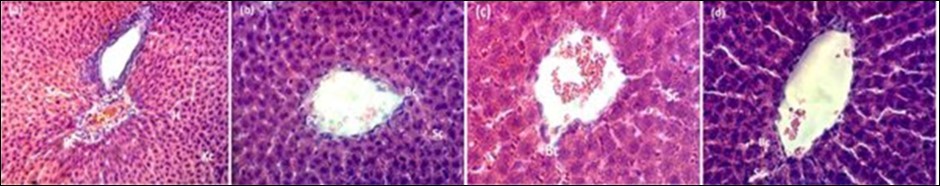 Histology study of liver of rats: (a) control group; (b) 200 mg/kg; (c) 400 mg/kg and (d) 600 of HM stem bark extract in a 28-days subacute toxicity. Biliary canal (Bc), Portal vein (Pv),             sinusoidal capillaries (Sc), Kupffer cells (Kc), hepatocytes (H). H.E (X 400).
