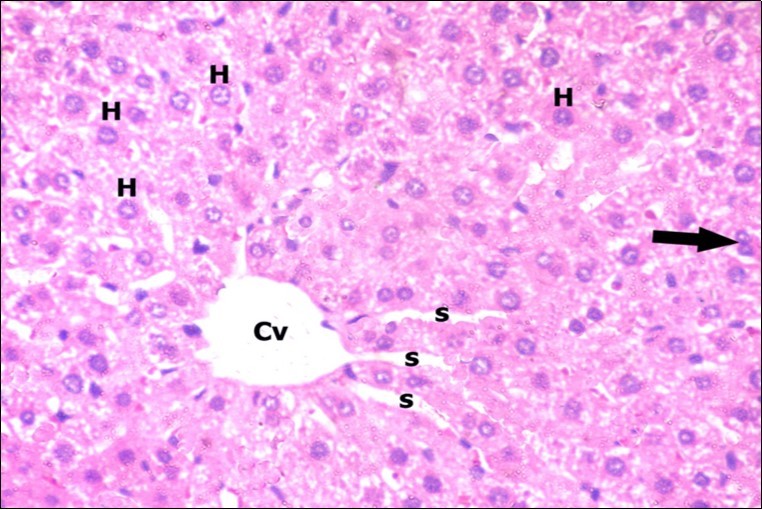 A photomicrograph of a section in the liver of a control adult albino rat showing polygonal hepatocytes (H) radiating from central vein (Cv) with rounded vesicular nuclei and acidophilic cytoplasm. Narrow radiating blood sinusoids (s) in between liver cords and their lining endothelium are noticed. Binucleated cell is also seen (thick arrow). (H&E  X400)