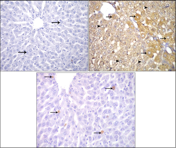 Photomicrographs of sections in the liver: (a) Control adult albino rat showing negative immune reaction for caspase 3 inside the cytoplasm of hepatocytes (arrow).                                     (b) ZnONPs-treated adult albino rat showing strong positive immune reaction for caspase 3 inside the cytoplasm of                  hepatocytes. (c) ZnONPs & VE-treated adult albino rat showing weak positive immune reaction for caspase 3 inside the                   cytoplasm of hepatocytes. (Immunoperoxidase technique for caspase 3   X 400)
