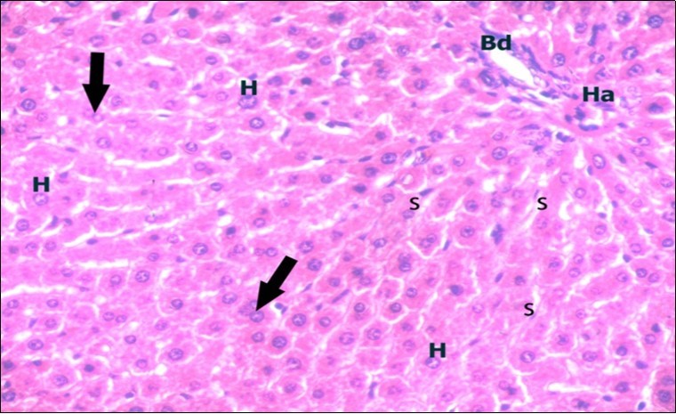 A photomicrograph of a section in the liver of a control adult albino rat showing portal area containing bile duct (Bd) and hepatic artery (Ha).                        Polygonal hepatocytes (H) with rounded vesicular nuclei and acidophilic                         cytoplasm can be observed. Narrow radiating blood sinusoids (s) in between liver cords and their lining endothelium are seen. Binucleated cells are also seen (thick arrows). (H&E  X400)
