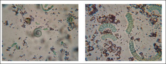Microscopic analysis of the capsule content