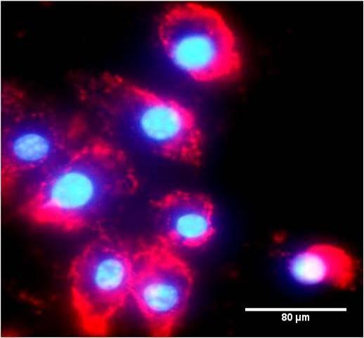 Rhodamine B labelled PCL NP internalized by THP1 cells after 6hrs incubation.
