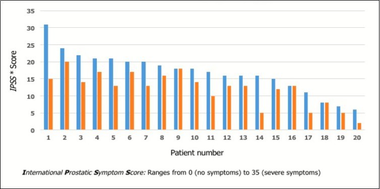 Urinary symptoms, evaluated according the IPSS* score, in patients with  benign prostatic hyperplasia before(blue) and after (red) Lycoprozen®treatment
