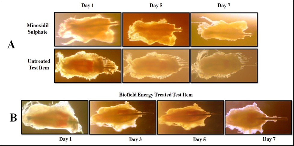 Representative photomicrograph of hair follicle development (anagen - catagen - telogen) of different treatment groups. A: Initiation of anagen follicle (thick hair bulb); B: Transformation of  initiation, regression of hair bulb, and shifting of the hair shaft (telogen follicle) in the Biofield Energy Treated test item (William’s Medium E) group .