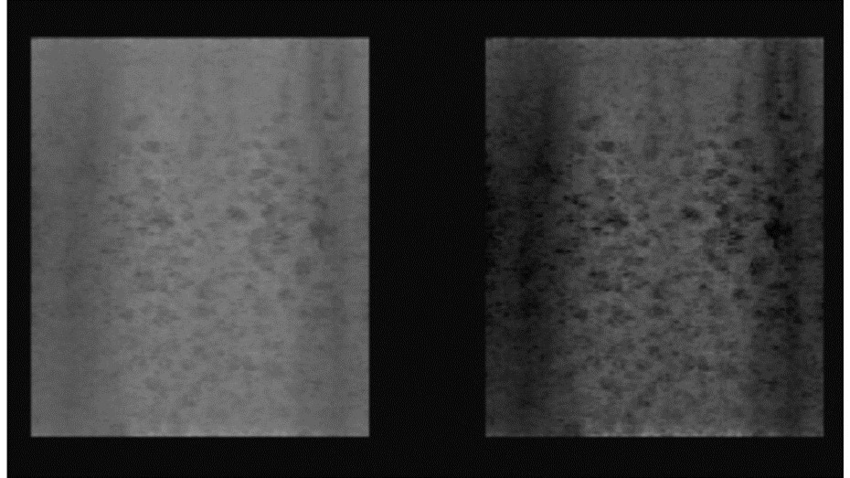 Random Void Phantom) - damaged transducer with inadequate contrast resolution (14.68 dB, Alloca SSD P52105). Original 3D rendered image (left), with increased image contrast (right). Small voids within the RVP with weak contrast cannot be visualised.