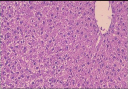 Photomicrograph of liver section of treated rat both with both fennel herb and Ator drug showing nearly normal hepatocytes  (H&E) (40X).