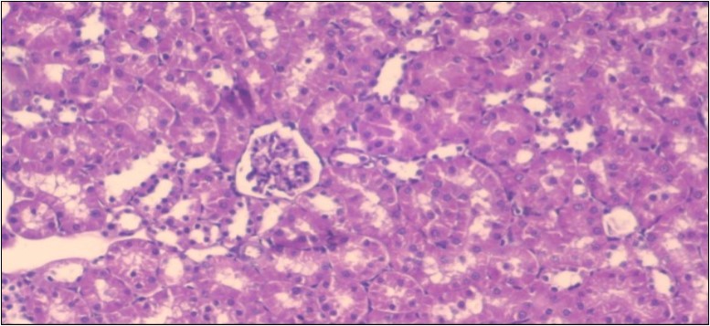 Photomicrogragh of  kidney section of      treated rat with fennel herb showing partial                      improvement in both Bowman's capsules  and proximal tubules. Note the distal tubules show less focal fatty infiltration, (H&E) (40X)