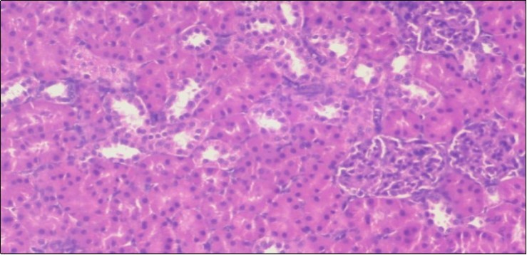 Photomicrograph of kidney section of treated rat with both fennel herb and Ator drug showing highly improved tissue with normal glomerular. Note, most Bowman's capsules and renal tubules, restoring their normal appearance (star).  (H&E) (40X).