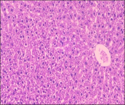 Photomicrograph of liver  section of                  treated rat with  fennel herb showing nearly normal of the hepatocytes with  eosinophilic cytoplasm,             central vein (CV) and clear blood  sinusoids  and more bi-nucleated cells , (H&E) (40X).