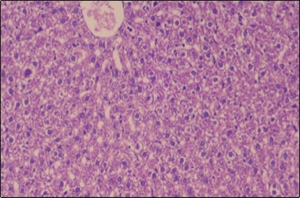Photomicrogragh of  liver section of treated rat with Ator drug  showing  mild fatty change in              hepatocytes, few hepatocytes retain is eosinophilic              cytoplasm and central vein , (H&E) (40X).