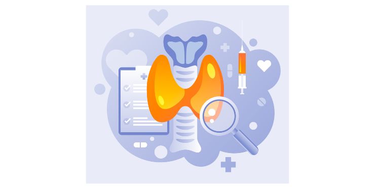 Article: Molecular Diagnosis in Clinical Management and Diagnosis of Thyroid Cancer